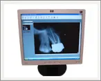 digital radiography